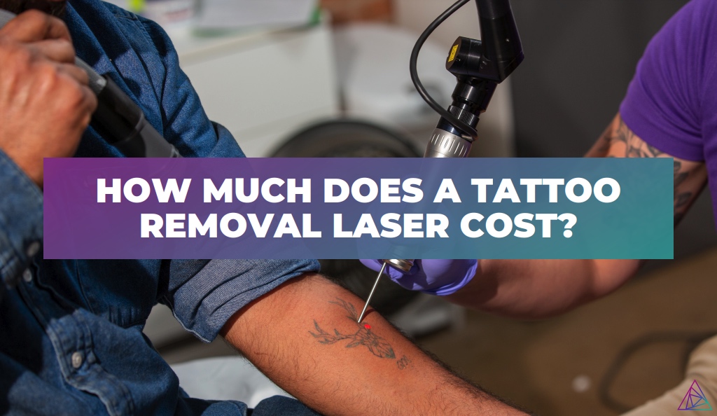 How Much Does A Tattoo Removal Laser Cost 